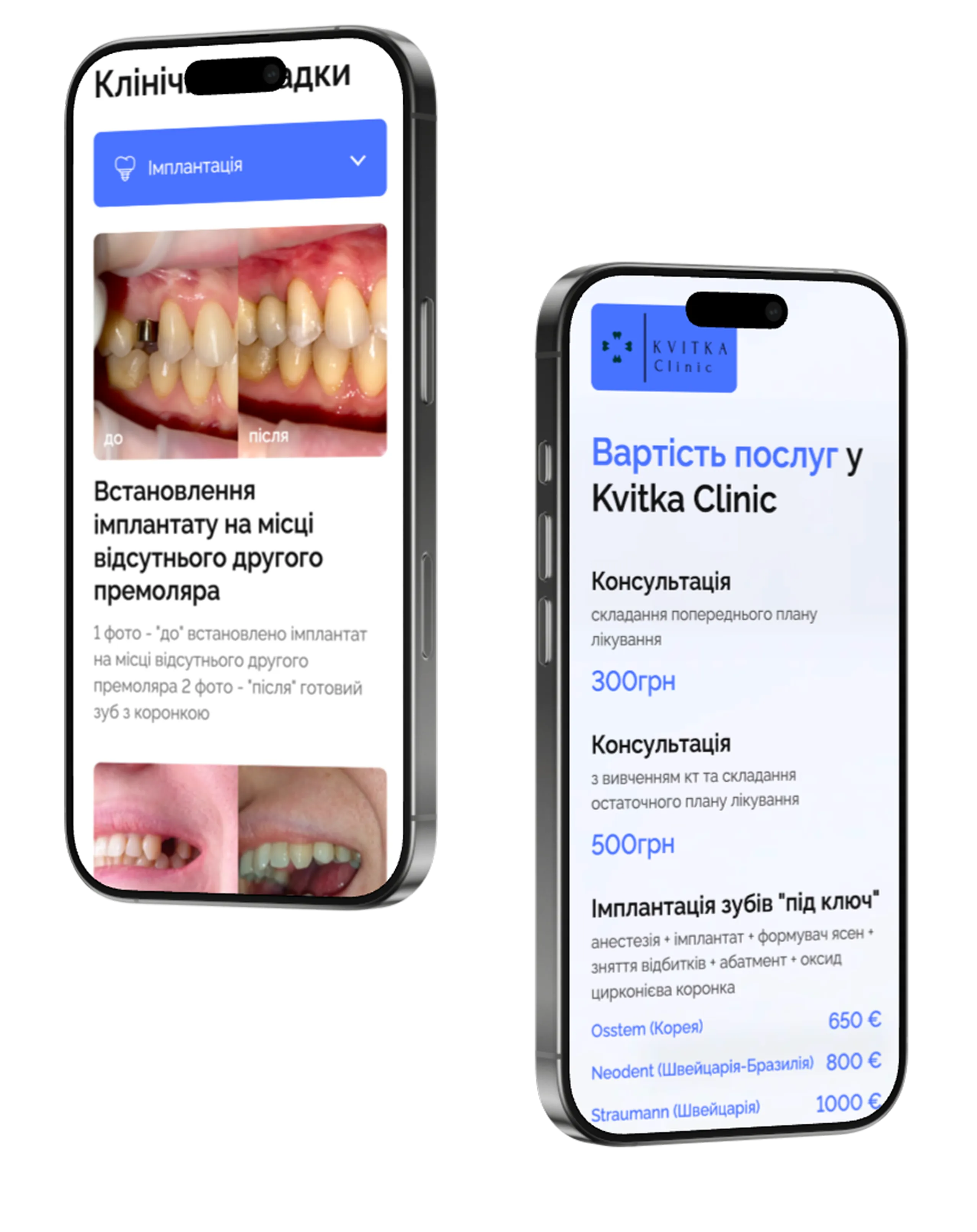 Дизайн сайту Kvitka Clinic — стоматологічна клініка, мобільна версія