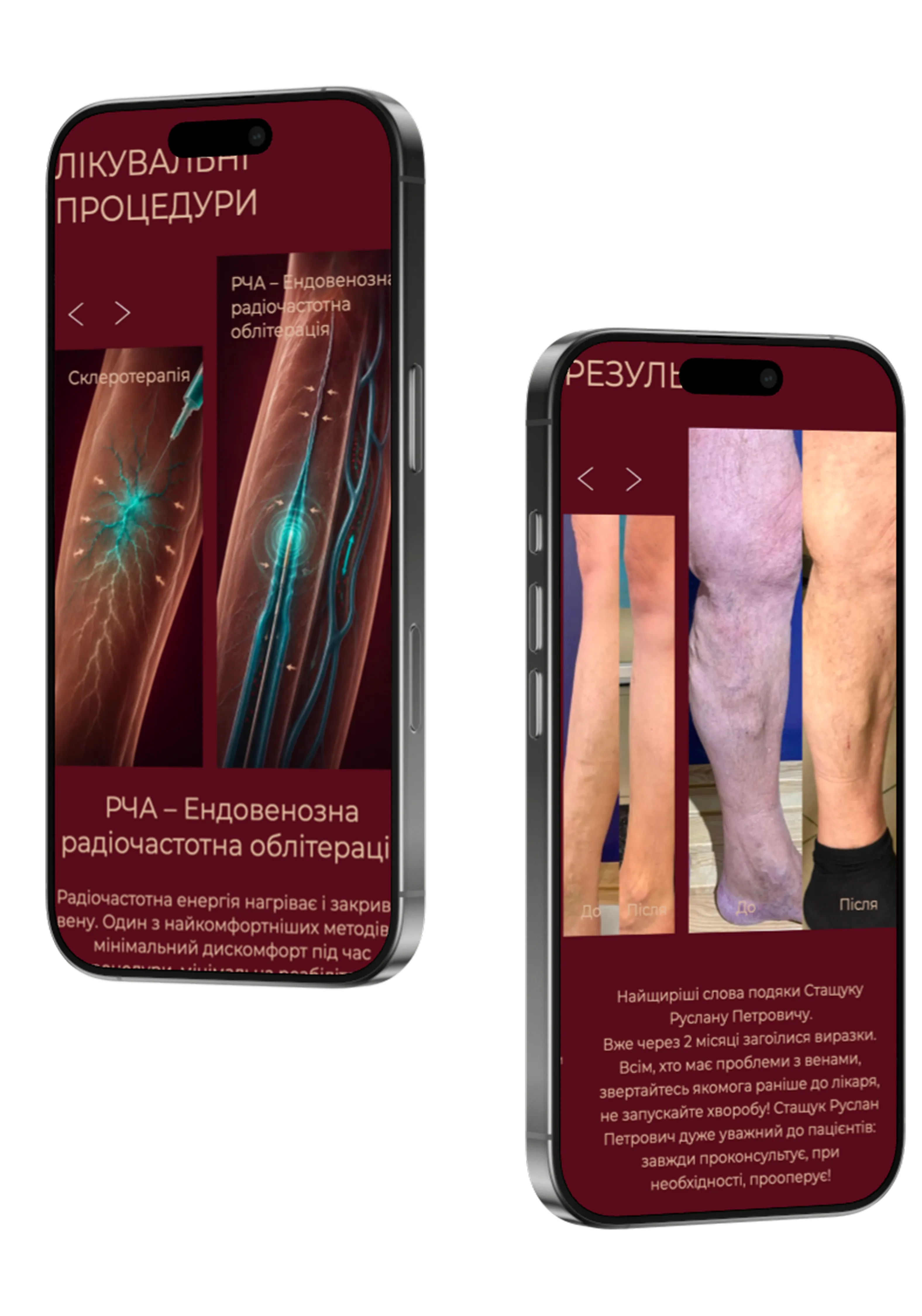 Версія mobile
